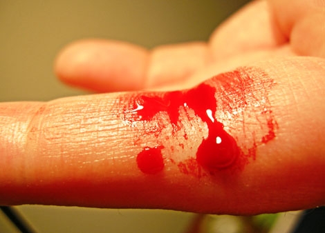 Stem Cells Key to Blood Production