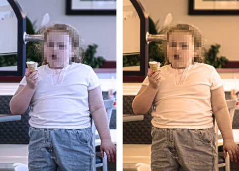 Obese Kids Also Joint Pain Sufferers