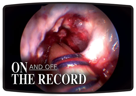 On (and Off) the Record
