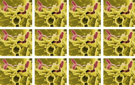 Non-Stick Coating Keeps Bacteria at Bay