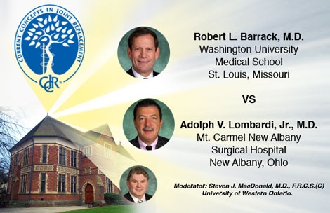 Barrack, Lombardi Square Off: MIS a Risk Factor for Failure?