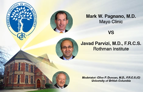 Pagnano and Parvizi Debate Squeaking Hips