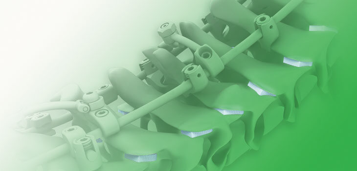 Medtronic Spine’s Newest Cervical Procedure