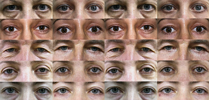 Cosmetic Surgery Stem Cell Debacle
