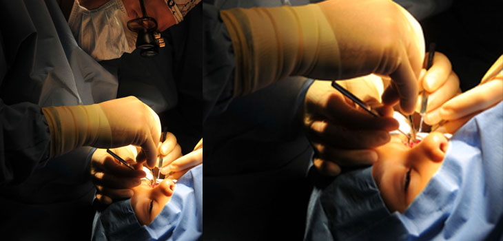 Stem Cell Implant Restores Sight