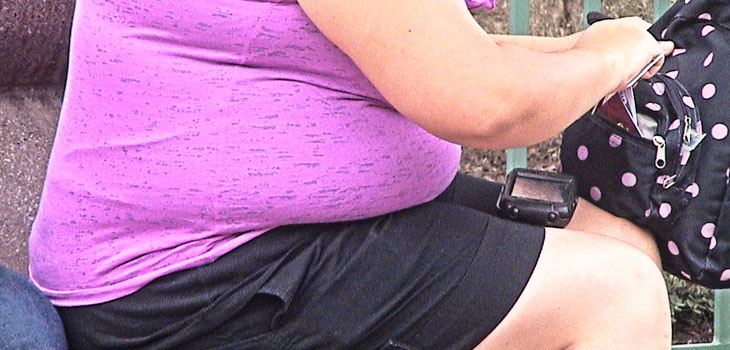 Obesity a Bummer for Ruptured Discs