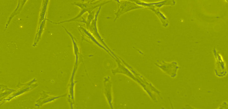 Stem Cells From Cadavers Are Viable