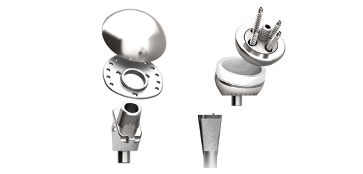 DePuy Synthes’ “Next-Generation” Shoulder System
