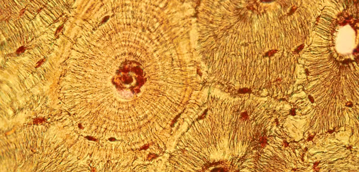 New Artificial Bone Created