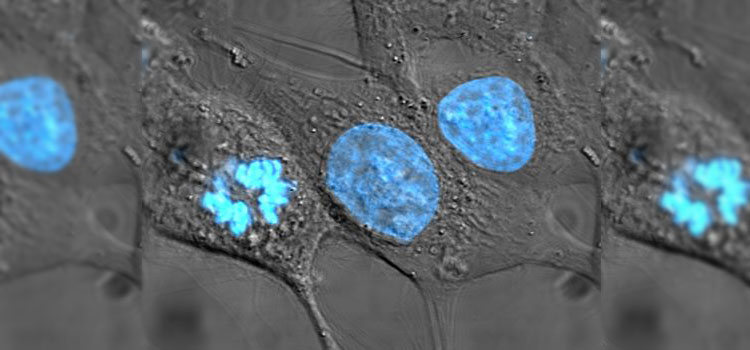 Kidney Tissue Generated From iPS Cells