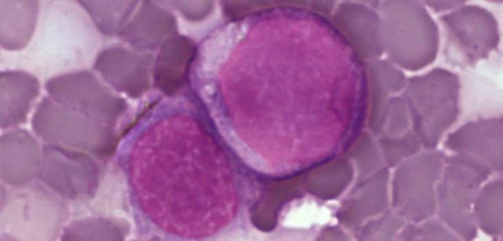 Synovium Stem Cell Shots Delay Cartilage Degeneration