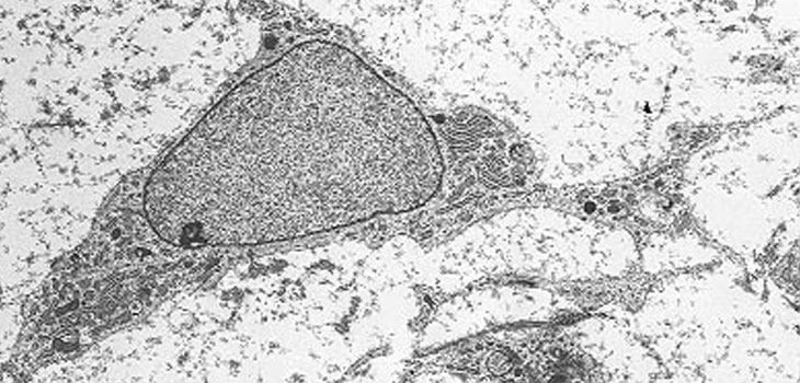 Stem Cells for Tendonitis Study at HSS…and More