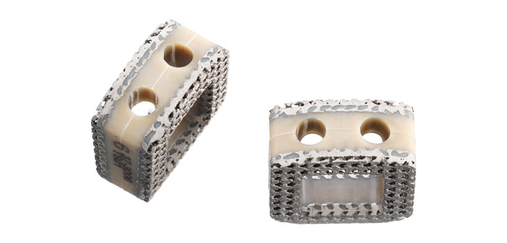 Clarification of Intended Use for Orthofix Spacer System
