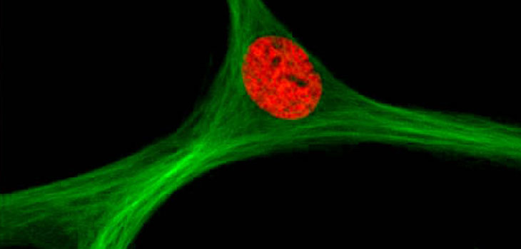 Stem Cells + HA New Injection for Knees?; Fracture Repair: Don’t Aim for Perfection!…and more…