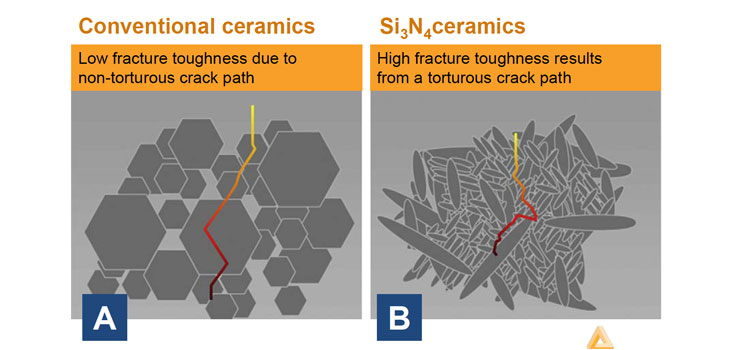 Amedica Patents Silicon Nitride Spinal Disc