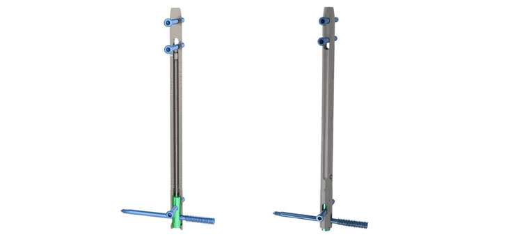 MedShape Launches 10mm DynaNail!