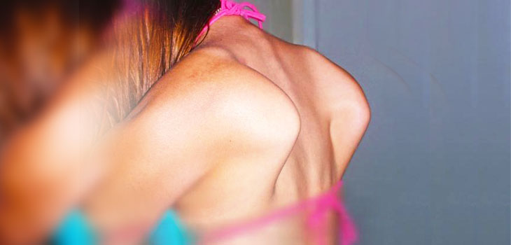 Double-Jointed Adolescents: More Musculoskeletal Pain