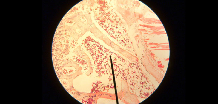 Stem Cells Own Niche in Bone Marrow