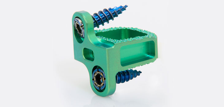 Dr. Geisler’s New Cervical Device