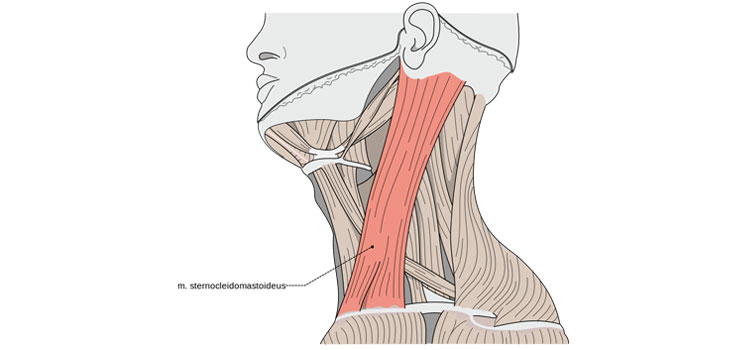 Neck Size & Strength Concussion Key