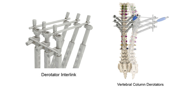 SpineCraft Signs Zimmer Spine Deal