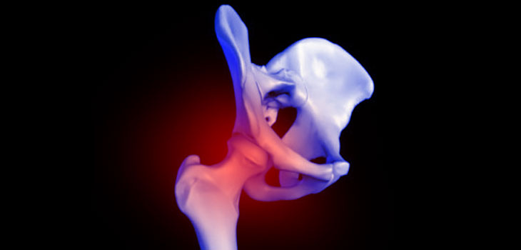 MoM Hips: Unexplained Pain Probably Tissue Damage
