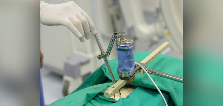 FOI Pioneers Robotic Spine Surgery