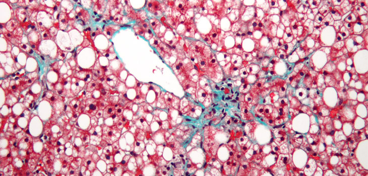 Brain Stem Cells Hint at Obesity Cure