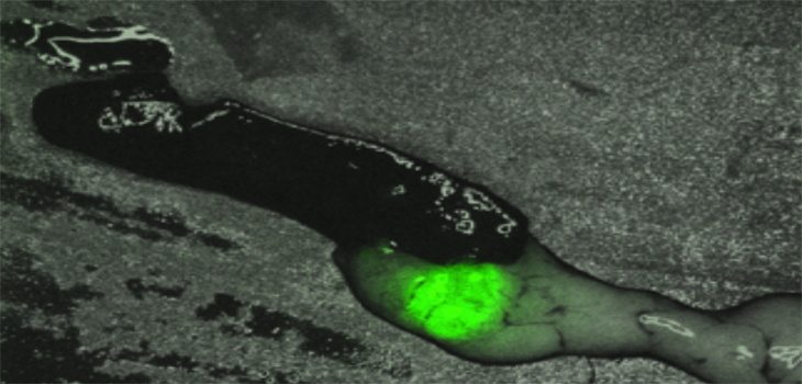 TissueGen: New Biodegradable Drug-Loaded Fibers