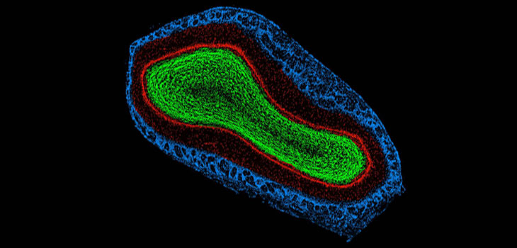 Vibrating Mesenchymal Stem Cells Grow Bone