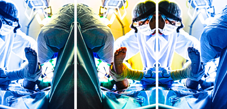 Surgeon Transplants Shin Bone With Meniscus