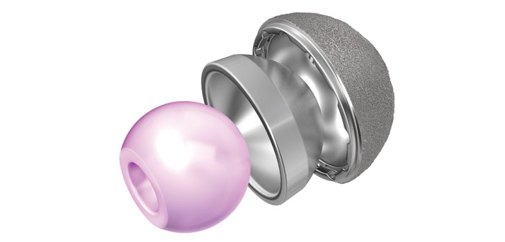 DePuy Dumps Metal-on-Metal