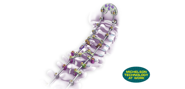 Medtronic Spine Launches at AANS