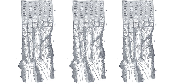 Hydrogel Plus Stromal Cells Repairs Cartilage