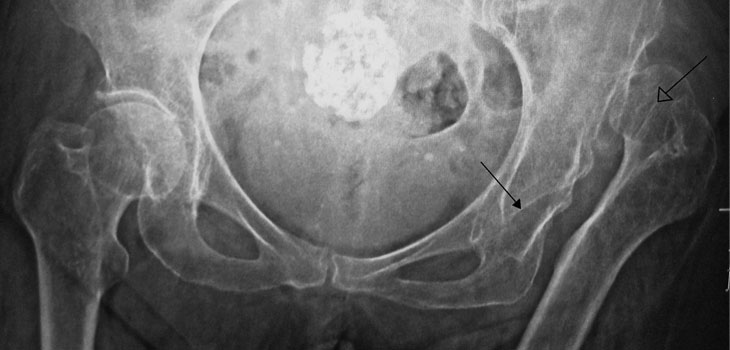 Government Forcing Orthopods Into Primary Care? // 500th O-Arm Installed // and More…