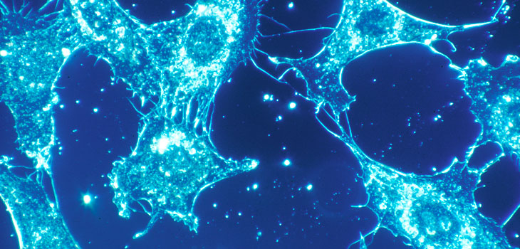 Major Study Update: Stem Cells Ease Back Pain