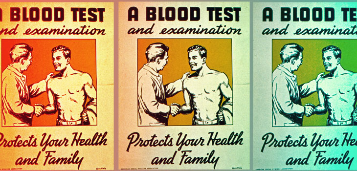 Blood Test ID’s Nickel Allergy