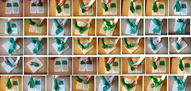 41 Surgical Gloves per Knee Surgery? Really?