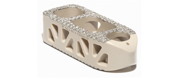 Spinal Elements: Patent Bonanza