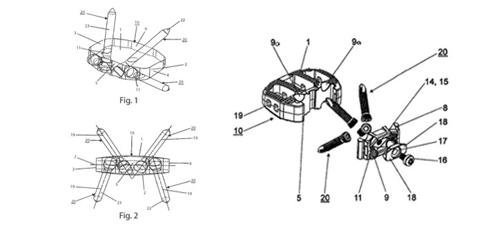 Globus Loses Patent Case to DePuy Synthes