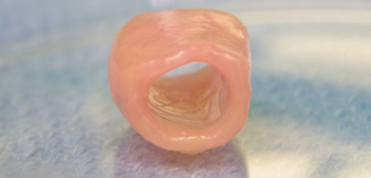 Can Stem Cells Heal Cartilage? Texas Doc to Find Out