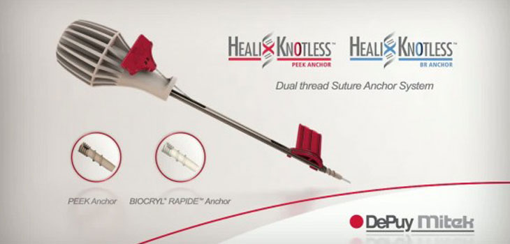 Mitek Launches New Rotator Cuff Anchors