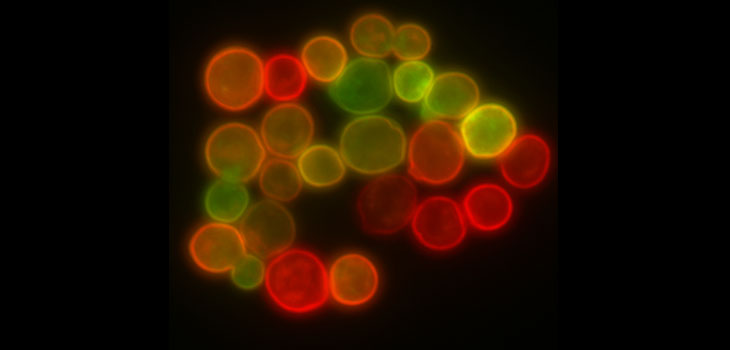 Iron Treatment Makes Stem Cells Visible