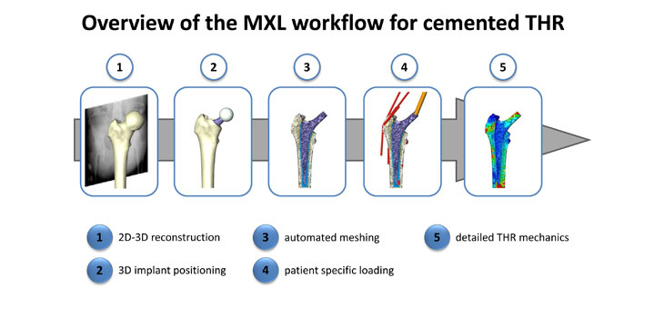 Extending the Lives of Joints