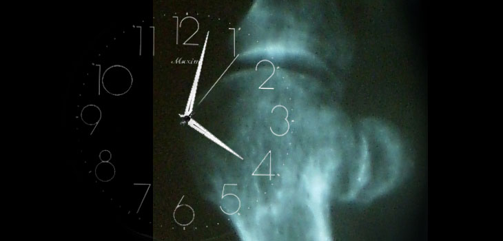 Cartilage Cells Have Body Clock: Effect on OA?
