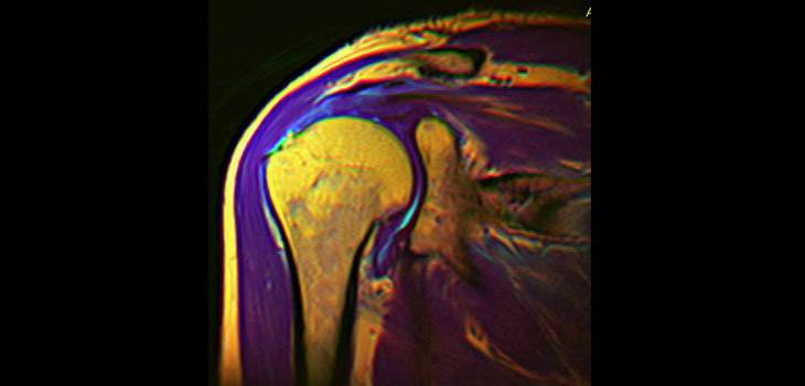 Guarantee a Surgical Outcome? Really? // New Shoulder Study Tackles Instability // and More