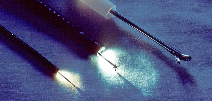 Endoscopy Best for Ankle Impingement Repair