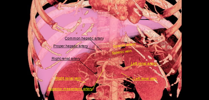 Med Students Delight – Cadaveric Vessels Colorized