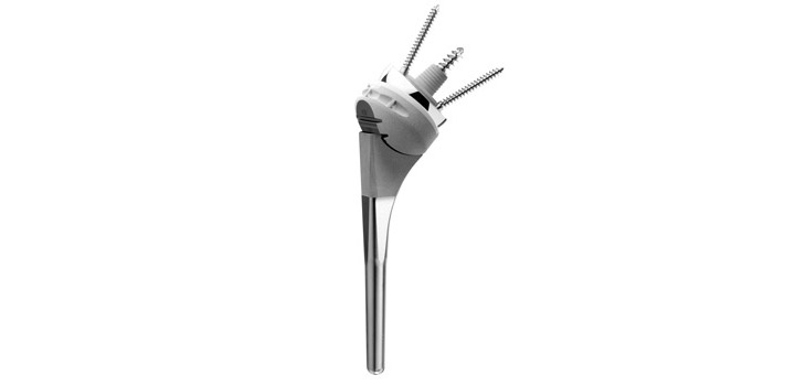 First Arthrex Reverse Shoulder Implant Surgery Performed