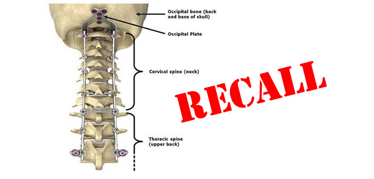Stryker Recalls Spine Plate